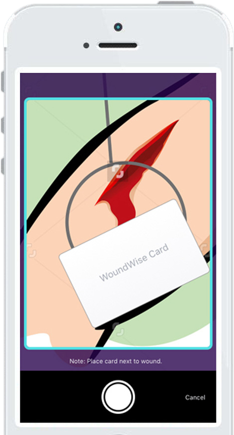 woundwise-transparent